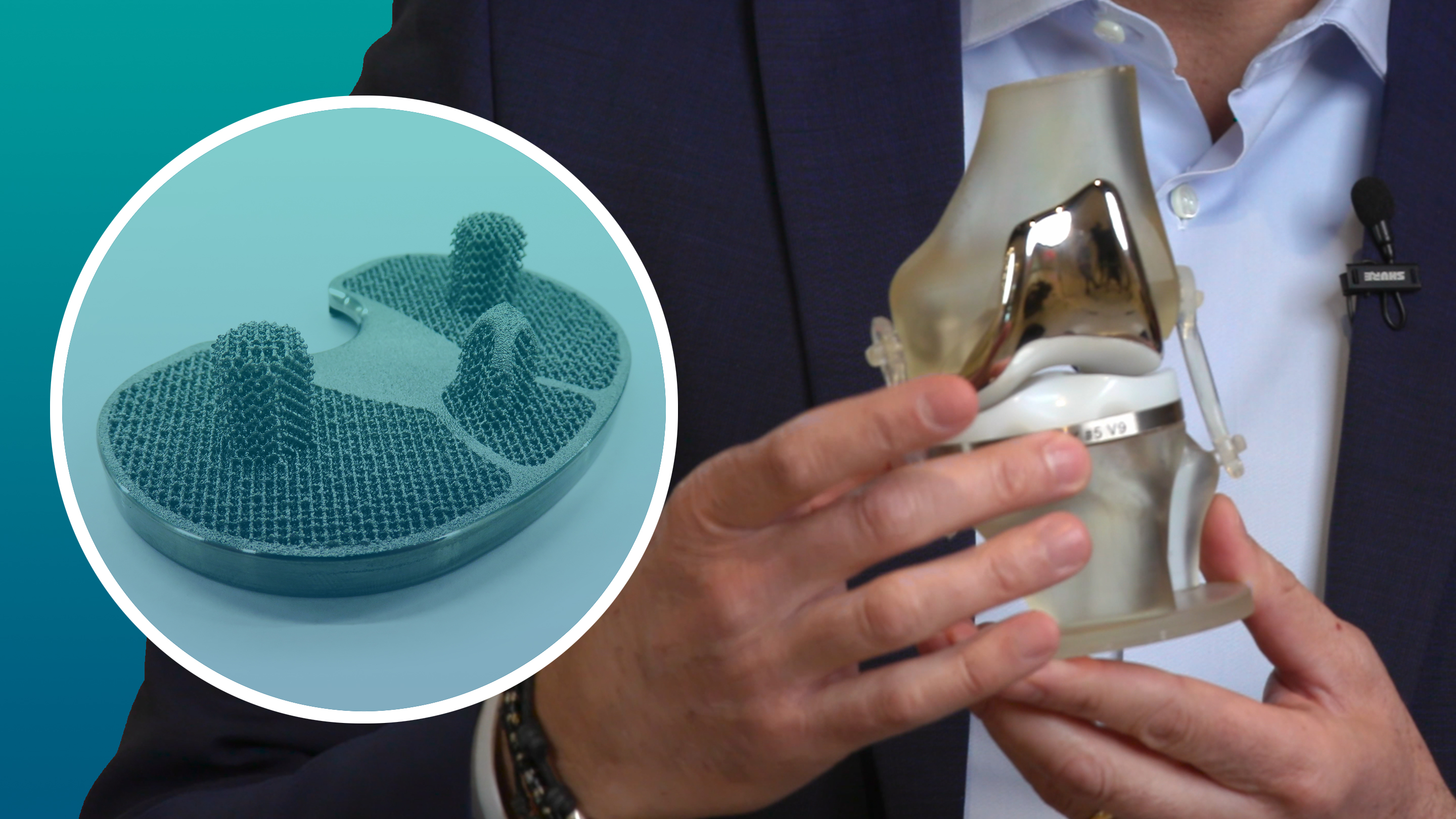 inar Additive Manufacturing for Medical Implants and Prosthetics by